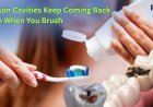 The Real Reason Cavities Keep Coming Back Even When You Brush