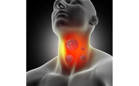 Early Signs and Symptoms of Thyroid Cancer You Should Not Ignore